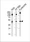 Lysosomal Associated Membrane Protein 1 antibody, TA324642, Origene, Western Blot image 