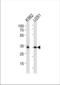 TATA-Box Binding Protein antibody, TA324859, Origene, Western Blot image 