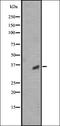Keratin 23 antibody, orb337796, Biorbyt, Western Blot image 