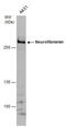 Neurofibromin 1 antibody, GTX132099, GeneTex, Western Blot image 