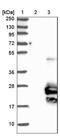 Transmembrane Protein 125 antibody, NBP1-81186, Novus Biologicals, Western Blot image 