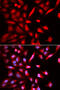 26S protease regulatory subunit 6A antibody, 14-934, ProSci, Immunofluorescence image 