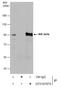 Inhibitor Of Nuclear Factor Kappa B Kinase Subunit Beta antibody, GTX107970, GeneTex, Immunoprecipitation image 