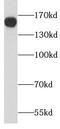 PTPRF Interacting Protein Alpha 1 antibody, FNab04797, FineTest, Western Blot image 