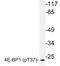 Eukaryotic Translation Initiation Factor 4E Binding Protein 1 antibody, LS-C178022, Lifespan Biosciences, Western Blot image 