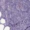 Transmembrane Protein 11 antibody, PA5-62483, Invitrogen Antibodies, Immunohistochemistry paraffin image 