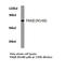 P21 (RAC1) Activated Kinase 3 antibody, LS-C177785, Lifespan Biosciences, Western Blot image 
