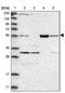 Succinyl-CoA:Glutarate-CoA Transferase antibody, NBP1-84270, Novus Biologicals, Western Blot image 