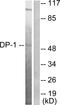 Transcription Factor Dp-1 antibody, LS-C118433, Lifespan Biosciences, Western Blot image 