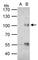 Forkhead Box O3 antibody, NBP2-16521, Novus Biologicals, Immunoprecipitation image 