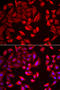 Chaperonin Containing TCP1 Subunit 2 antibody, 22-302, ProSci, Immunofluorescence image 