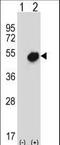 Nuclear Receptor Subfamily 0 Group B Member 1 antibody, LS-C162981, Lifespan Biosciences, Western Blot image 