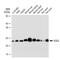 Superoxide Dismutase 2 antibody, GTX09013, GeneTex, Western Blot image 