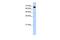 Coiled-coil domain-containing protein 38 antibody, GTX45534, GeneTex, Western Blot image 