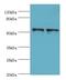 SPTLC1 antibody, LS-C376681, Lifespan Biosciences, Western Blot image 