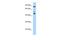 Testin LIM Domain Protein antibody, A01266, Boster Biological Technology, Western Blot image 