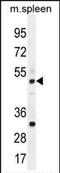 TBC1 Domain Family Member 13 antibody, PA5-35080, Invitrogen Antibodies, Western Blot image 