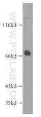 NPL4 Homolog, Ubiquitin Recognition Factor antibody, 11638-1-AP, Proteintech Group, Western Blot image 