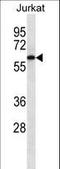 Calcium/Calmodulin Dependent Protein Kinase Kinase 2 antibody, LS-C168288, Lifespan Biosciences, Western Blot image 