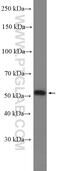 TNF Receptor Associated Factor 4 antibody, 10083-2-AP, Proteintech Group, Western Blot image 