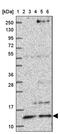 ATPase H+ Transporting V1 Subunit F antibody, PA5-63998, Invitrogen Antibodies, Western Blot image 
