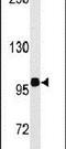 Homeodomain Interacting Protein Kinase 2 antibody, PA5-14471, Invitrogen Antibodies, Western Blot image 