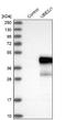 Ubiquitin Conjugating Enzyme E2 J1 antibody, NBP1-85654, Novus Biologicals, Western Blot image 