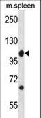 ABL Proto-Oncogene 1, Non-Receptor Tyrosine Kinase antibody, LS-C164283, Lifespan Biosciences, Western Blot image 