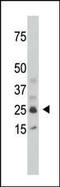 Sulfotransferase Family 1C Member 2 antibody, PA5-12242, Invitrogen Antibodies, Western Blot image 