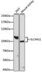 SLC4A11 antibody, A15910, ABclonal Technology, Western Blot image 