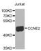 Cyclin E2 antibody, orb373527, Biorbyt, Western Blot image 
