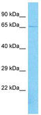 ArfGAP With GTPase Domain, Ankyrin Repeat And PH Domain 11 antibody, TA335409, Origene, Western Blot image 