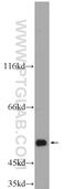 Aldehyde dehydrogenase family 1 member A3 antibody, 25167-1-AP, Proteintech Group, Western Blot image 