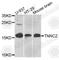 Troponin C2, Fast Skeletal Type antibody, A7740, ABclonal Technology, Western Blot image 