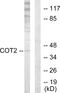 Nuclear Receptor Subfamily 2 Group F Member 2 antibody, LS-C118833, Lifespan Biosciences, Western Blot image 