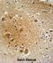 SPARCL1 antibody, abx025636, Abbexa, Immunohistochemistry paraffin image 