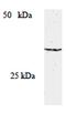 Suppressor of cytokine signaling 2 antibody, GTX23692, GeneTex, Western Blot image 