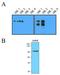 Hexokinase 2 antibody, NBP1-04296, Novus Biologicals, Western Blot image 