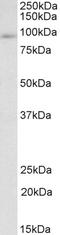 FYN Binding Protein 1 antibody, EB08254, Everest Biotech, Western Blot image 