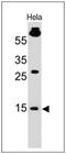 Small Ubiquitin Like Modifier 1 antibody, GTX35092, GeneTex, Western Blot image 