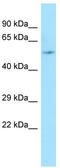 Rho GTPase Activating Protein 8 antibody, TA337735, Origene, Western Blot image 