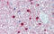 One Cut Homeobox 1 antibody, ARP38481_P050, Aviva Systems Biology, Immunohistochemistry paraffin image 