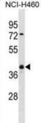 Ubiquitin C-Terminal Hydrolase L5 antibody, abx031361, Abbexa, Western Blot image 