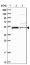 Iroquois Homeobox 1 antibody, NBP1-83090, Novus Biologicals, Western Blot image 