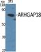 Rho GTPase-activating protein 18 antibody, A08418, Boster Biological Technology, Western Blot image 