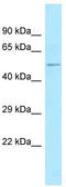 Kelch Like Family Member 1 antibody, TA335496, Origene, Western Blot image 