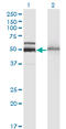 Hexosaminidase Subunit Alpha antibody, LS-C197404, Lifespan Biosciences, Western Blot image 