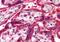 Nei Like DNA Glycosylase 1 antibody, PA5-18134, Invitrogen Antibodies, Immunohistochemistry paraffin image 