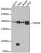 Lysine Demethylase 5B antibody, MBS9128346, MyBioSource, Western Blot image 