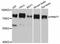 Protein Arginine Methyltransferase 7 antibody, STJ114052, St John